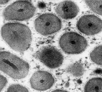 图1　稻纵卷叶螟颗粒体病毒的包涵体切面（一个包涵体内只有一个病毒粒）