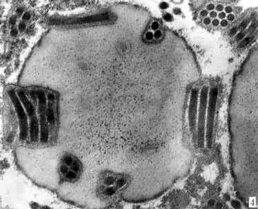 图4　棉铃虫核型多角体病毒的包涵体切面（多粒包埋型）