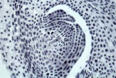 小麦大孢子的发育——大孢子孢原细胞