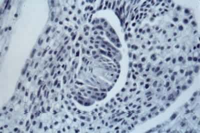 小麦大孢子的发育——大孢子母细胞