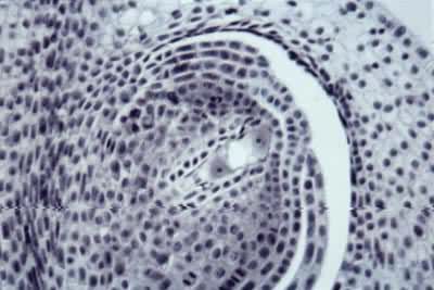 小麦大孢子的发育——2核胚囊