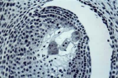 小麦大孢子的发育——成熟胚囊