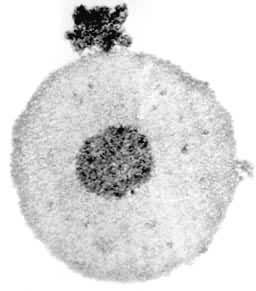 图7 长趾钝口螈 球体的电镜照片，示其电子密度致密的髓心。标尺为1微米