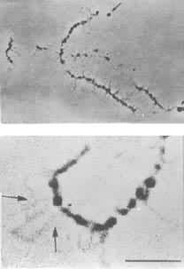 图11 上：地中海伞藻的灯刷染色体，箭 头为末端携带的小球；下：放大的灯刷染色体的一部分，示染色体轴、染色粒和侧环(箭头)