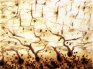 动物组织——扇形树突神经元