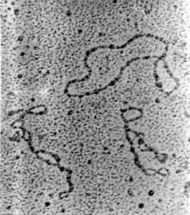 图1　大肠杆菌质粒pBR322的电镜照相