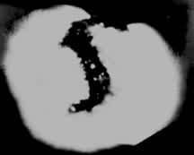 图1  用X射线拍摄到的1973年8月21日的冕洞