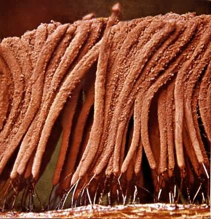 发网菌——一种粘菌，高1.5cm