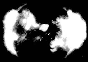 图4  1970年11月4日用X射线拍摄到的日冕像