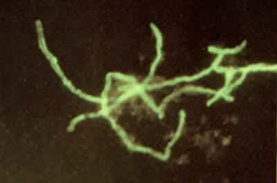 脑脓肿组织中生长的衣氏放线菌