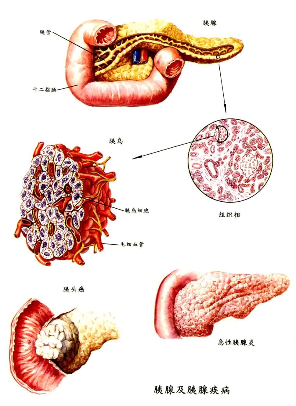 胰腺及胰腺疾病