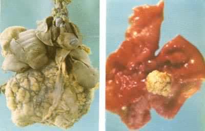 黄曲霉毒素诱发的大鼠肝癌（左）和前胃乳头状瘤（右）