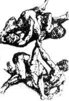 图5　古希腊斯巴达的拳击与角力混合竟技──“潘克拉蒂奥”